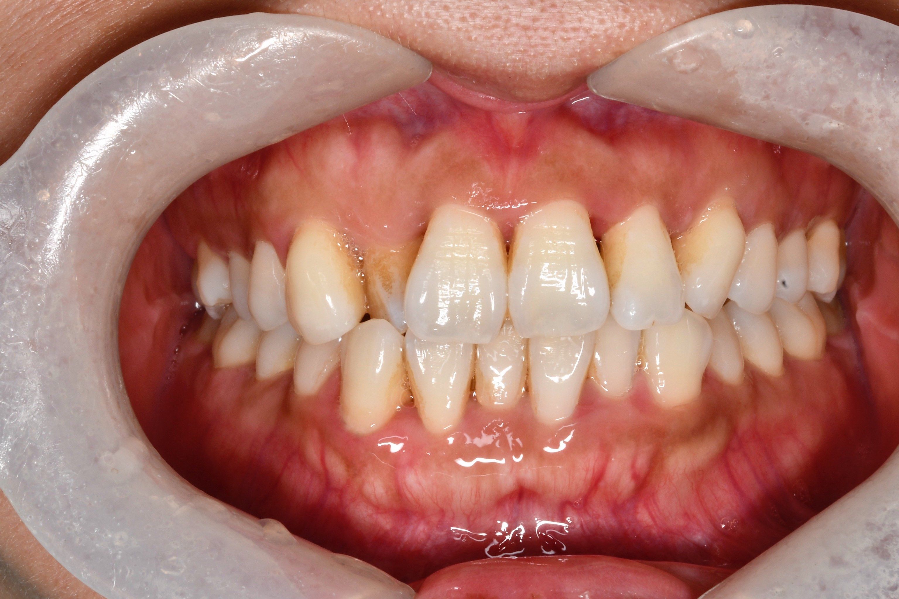 d43cf0c93681c09a5ffc3eee872c30bc_xhxM_YX0tpL10DWRHq4OjnKyh9tzlxpVbe3lMZIG4uxTLyq1kbIKqgaHguXO0-Gl